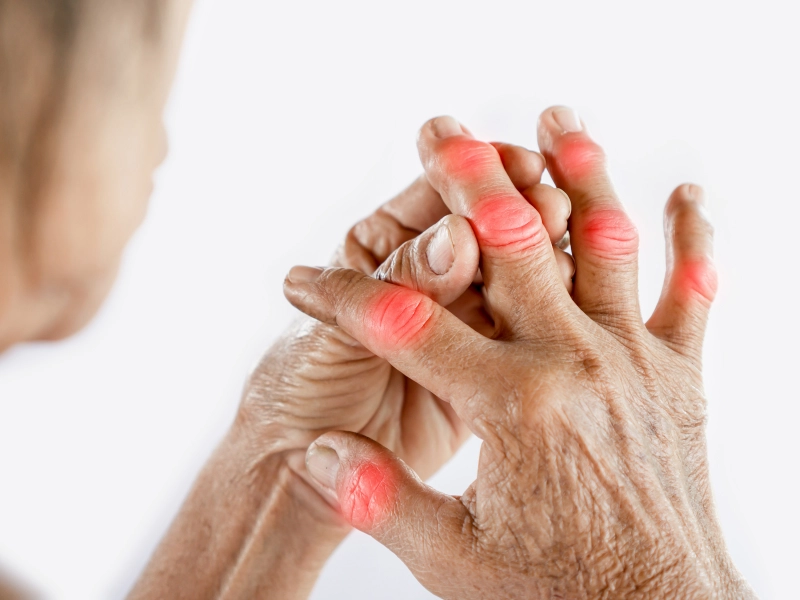 treatment for arm pain and hand pain in Colorado Springs, co